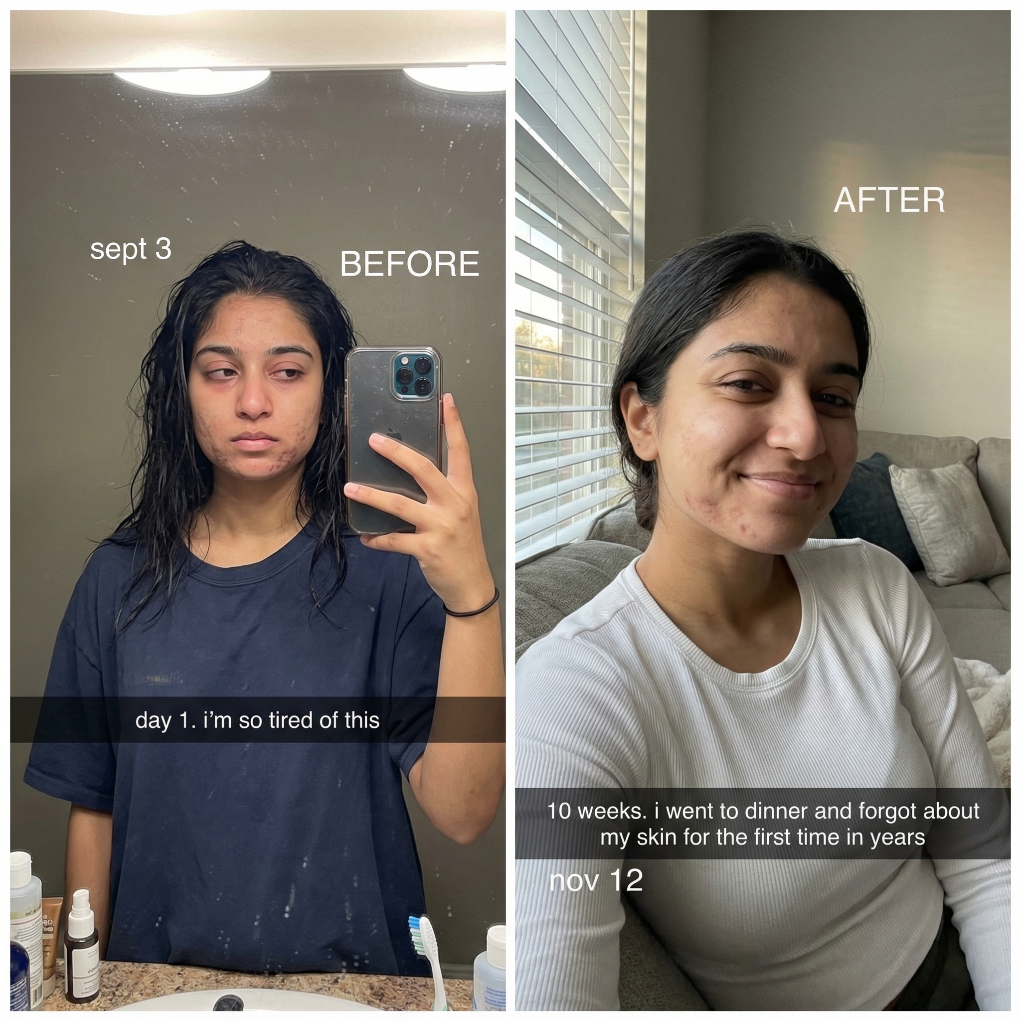 THE CLEAR FORTRESS™ - 3-Phase Acne Defense System