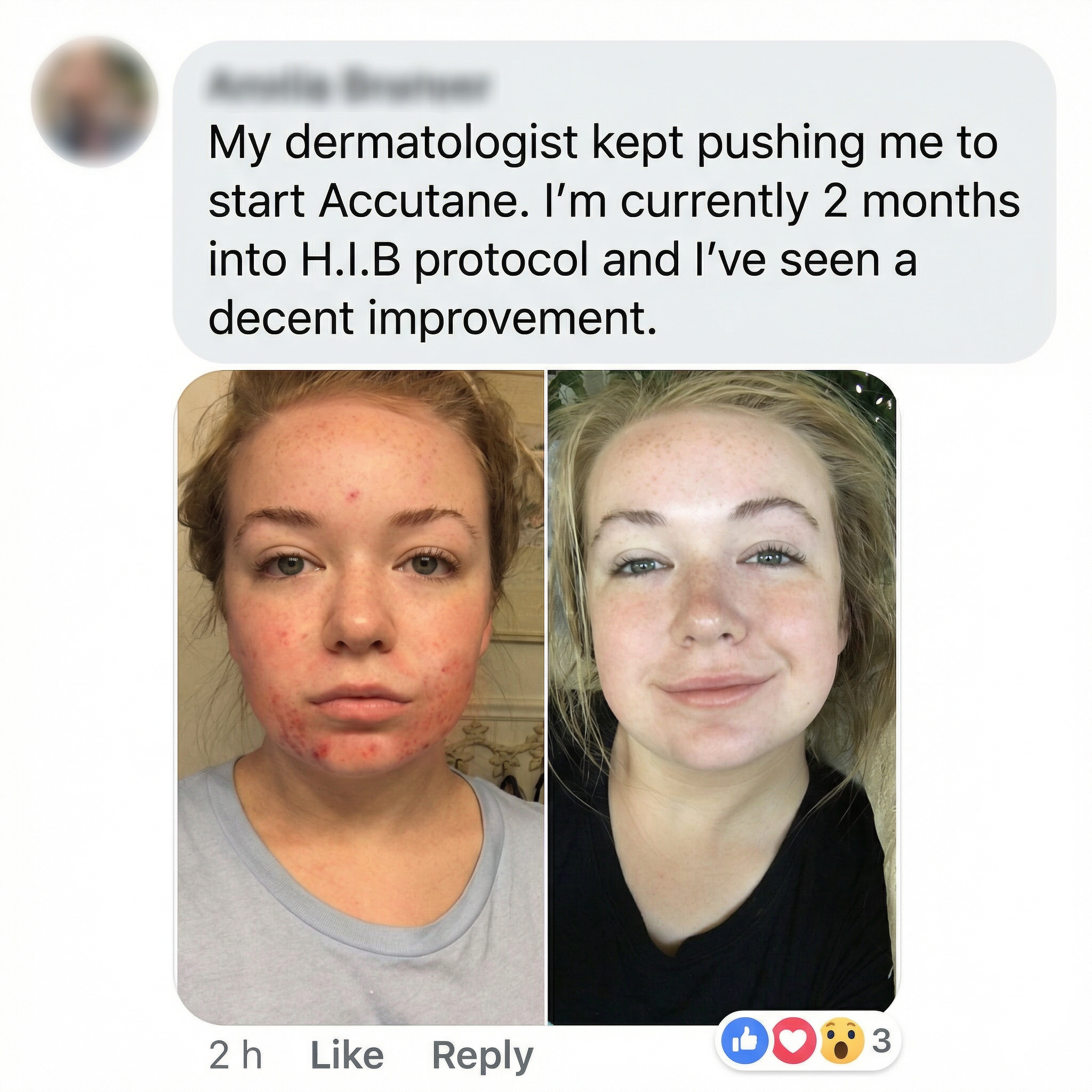 THE CLEAR FORTRESS™ - 3-Phase Acne Defense System