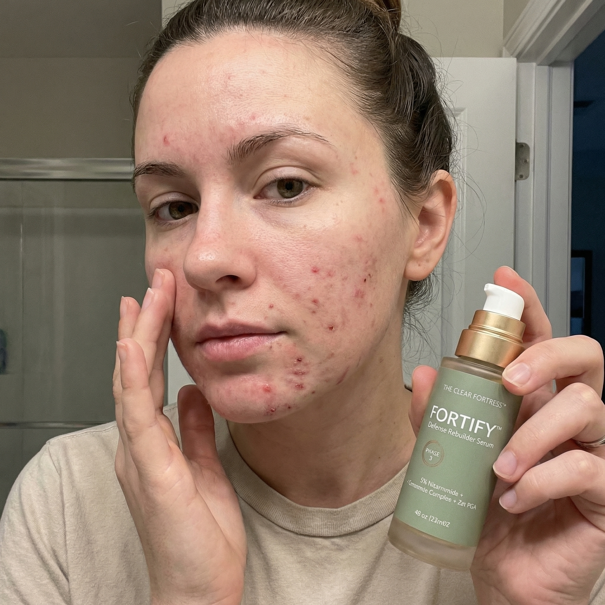 THE CLEAR FORTRESS™ - 3-Phase Acne Defense System