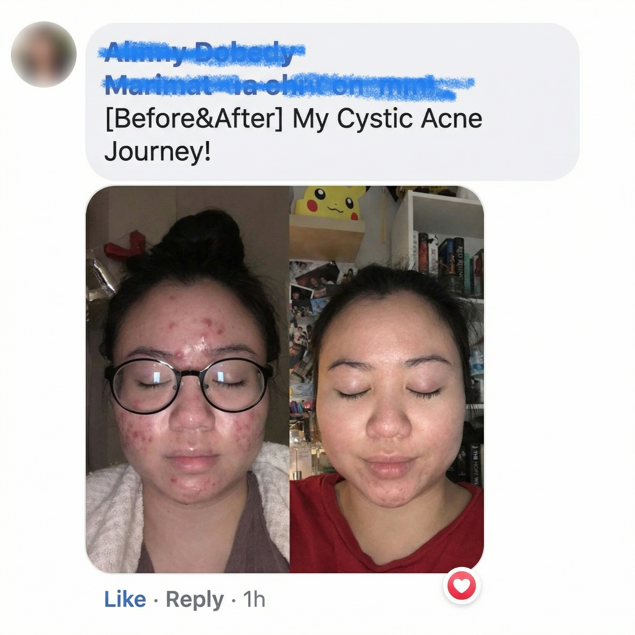 THE CLEAR FORTRESS™ - 3-Phase Acne Defense System