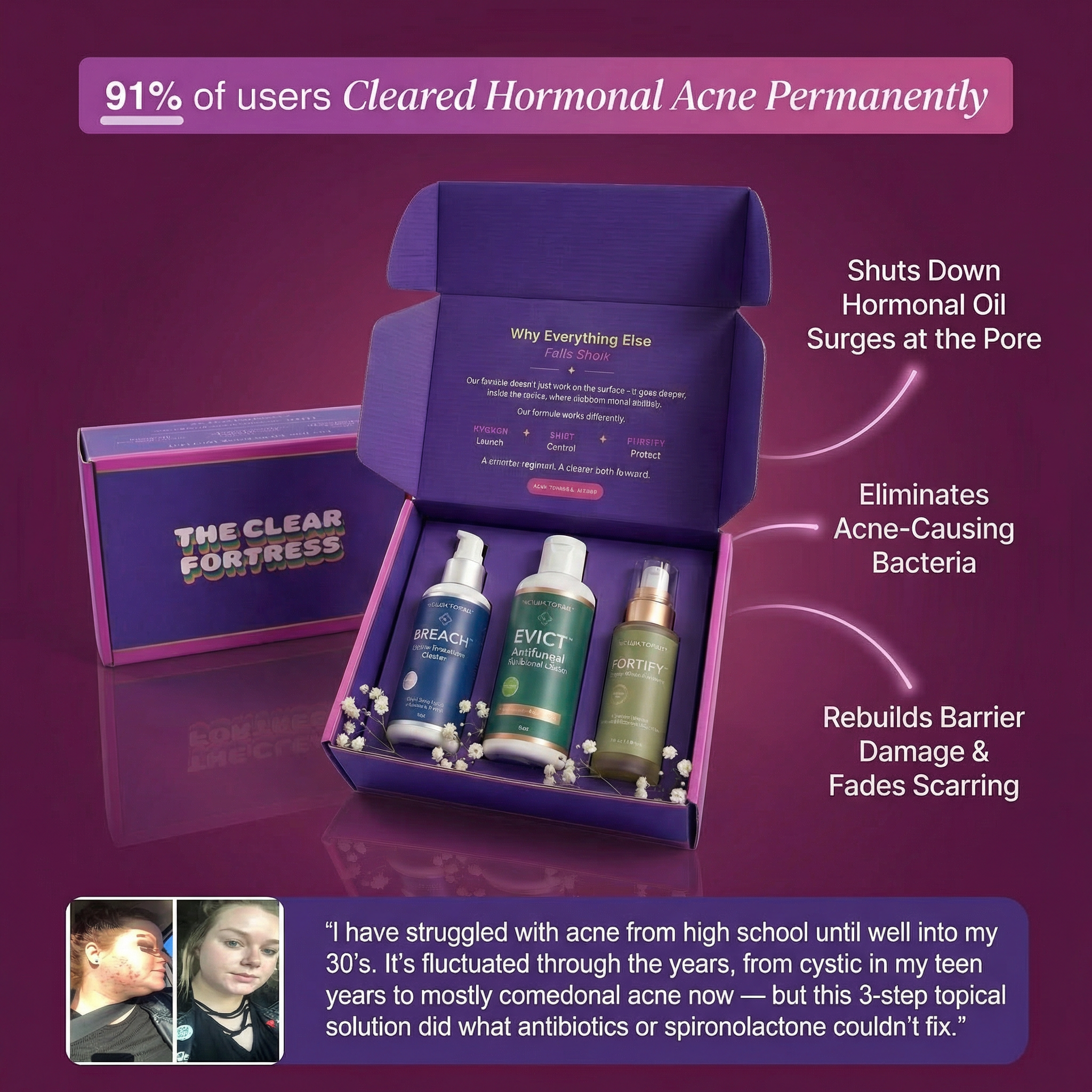 THE CLEAR FORTRESS™ - 3-Phase Acne Defense System